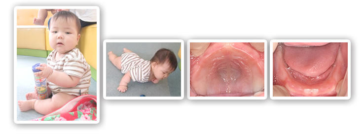 赤ちゃんスクスク体操